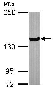 Western blot - Anti-NUP155 antibody (AB155904), expandable thumbnail