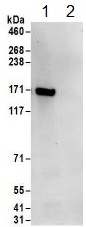 Immunoprecipitation - Anti-NUP155 antibody (AB157104)