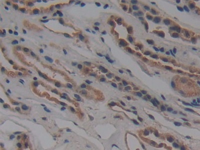 Immunohistochemistry (Formalin/PFA-fixed paraffin-embedded sections) - Anti-NUP155 antibody (AB233079), expandable thumbnail