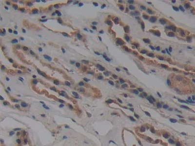 Immunohistochemistry (Formalin/PFA-fixed paraffin-embedded sections) - Anti-NUP155 antibody (AB233079)