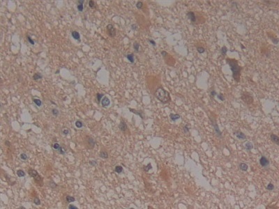 Immunohistochemistry (Formalin/PFA-fixed paraffin-embedded sections) - Anti-NUP155 antibody (AB233079), expandable thumbnail