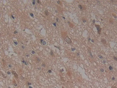 Immunohistochemistry (Formalin/PFA-fixed paraffin-embedded sections) - Anti-NUP155 antibody (AB233079)