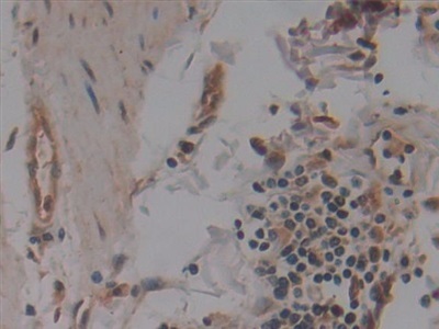 Immunohistochemistry (Formalin/PFA-fixed paraffin-embedded sections) - Anti-NUP155 antibody (AB233079), expandable thumbnail