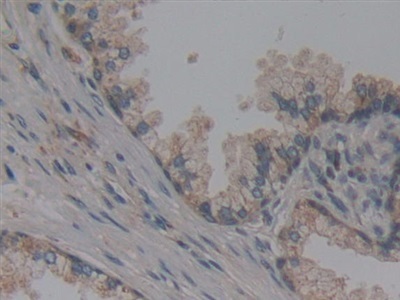 Immunohistochemistry (Formalin/PFA-fixed paraffin-embedded sections) - Anti-NUP155 antibody (ab233079), expandable thumbnail