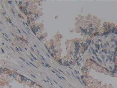 Immunohistochemistry (Formalin/PFA-fixed paraffin-embedded sections) - Anti-NUP155 antibody (AB233079)