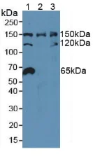 Western blot - Anti-NUP155 antibody (AB233079)