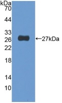 Western blot - Anti-NUP155 antibody (AB233079), expandable thumbnail