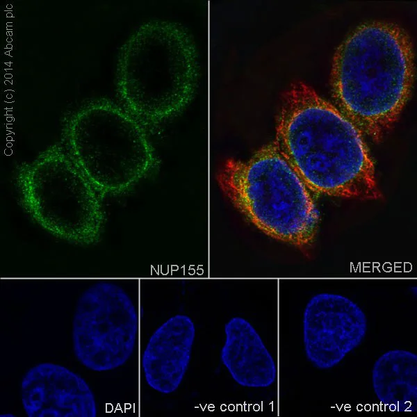 Immunocytochemistry/ Immunofluorescence - Anti-NUP155 antibody [EPR17111] - BSA and Azide free (AB251277)