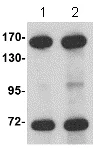Western blot - Anti-NUP160 antibody (AB73293)