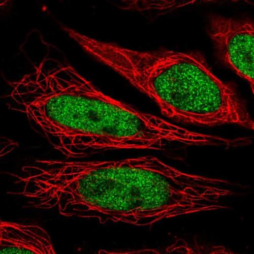 Immunocytochemistry/ Immunofluorescence - Anti-NUP188 antibody (AB204490)