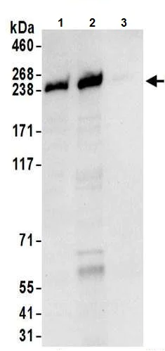 Immunoprecipitation - Anti-NUP205 antibody (AB157090)