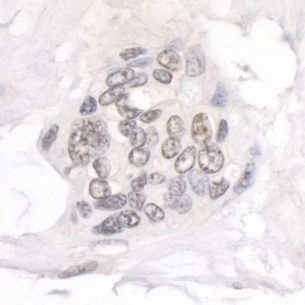Immunohistochemistry (Formalin/PFA-fixed paraffin-embedded sections) - Anti-NUP214 antibody (AB70497)