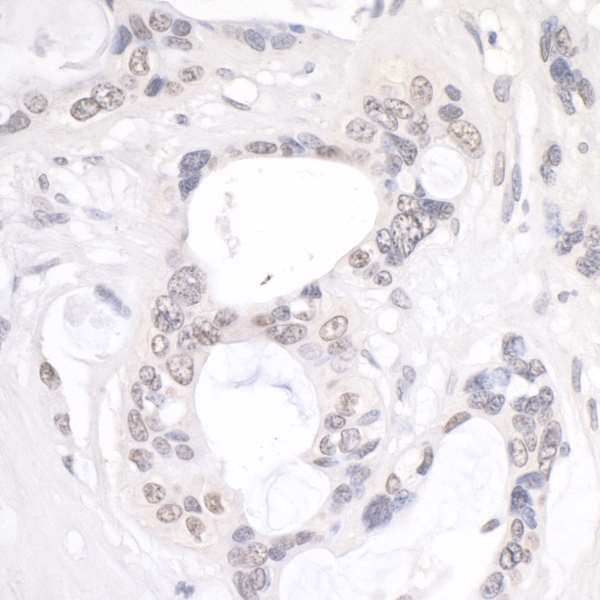 Immunohistochemistry (Formalin/PFA-fixed paraffin-embedded sections) - Anti-NUP214 antibody (AB70497)