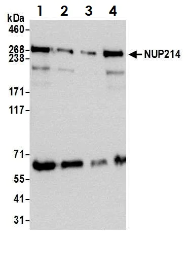 Western blot - Anti-NUP214 antibody (AB70497)