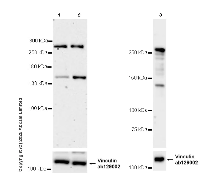 Western blot - Anti-NUP214 antibody [EPR29100-623] - BSA and Azide free (AB325247)