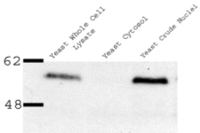 Western blot - Anti-NUP35 antibody (AB11692), expandable thumbnail