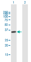 Western blot - Anti-NUP35 antibody (AB169162)