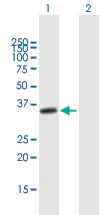 Western blot - Anti-NUP35 antibody (AB169162)