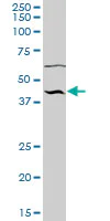 Western blot - Anti-NUP43 antibody (AB69447)