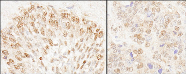 Immunohistochemistry (Formalin/PFA-fixed paraffin-embedded sections) - Anti-NUP50 antibody (AB85915)