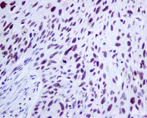 Immunohistochemistry (Formalin/PFA-fixed paraffin-embedded sections) - Anti-NUP50 antibody [EPR9525] (AB151567)