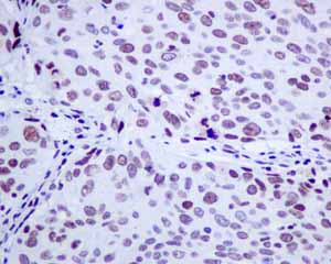 Immunohistochemistry (Formalin/PFA-fixed paraffin-embedded sections) - Anti-NUP50 antibody [EPR9525] (AB151567)