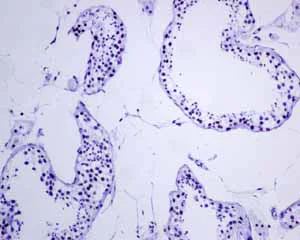 Immunohistochemistry (Formalin/PFA-fixed paraffin-embedded sections) - Anti-NUP50 antibody [EPR9525] (AB151567)