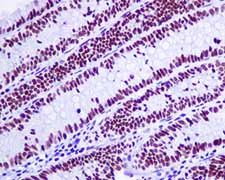 Immunohistochemistry (Formalin/PFA-fixed paraffin-embedded sections) - Anti-NUP50 antibody [EPR9525] (AB151567)