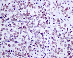 Immunohistochemistry (Formalin/PFA-fixed paraffin-embedded sections) - Anti-NUP50 antibody [EPR9525] - BSA and Azide free (AB240121)