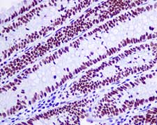Immunohistochemistry (Formalin/PFA-fixed paraffin-embedded sections) - Anti-NUP50 antibody [EPR9525] - BSA and Azide free (AB240121)