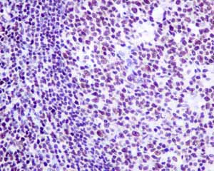 Immunohistochemistry (Formalin/PFA-fixed paraffin-embedded sections) - Anti-NUP50 antibody [EPR9525] - BSA and Azide free (AB240121)