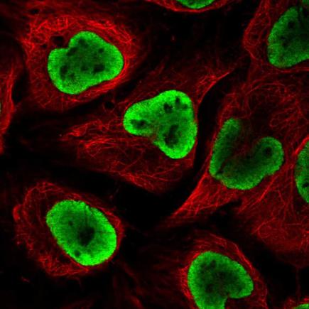 Immunocytochemistry/ Immunofluorescence - Anti-NUP54 antibody (AB220890)