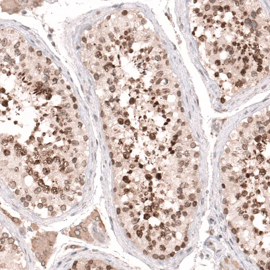 Immunohistochemistry (Formalin/PFA-fixed paraffin-embedded sections) - Anti-NUP54 antibody (AB254722)