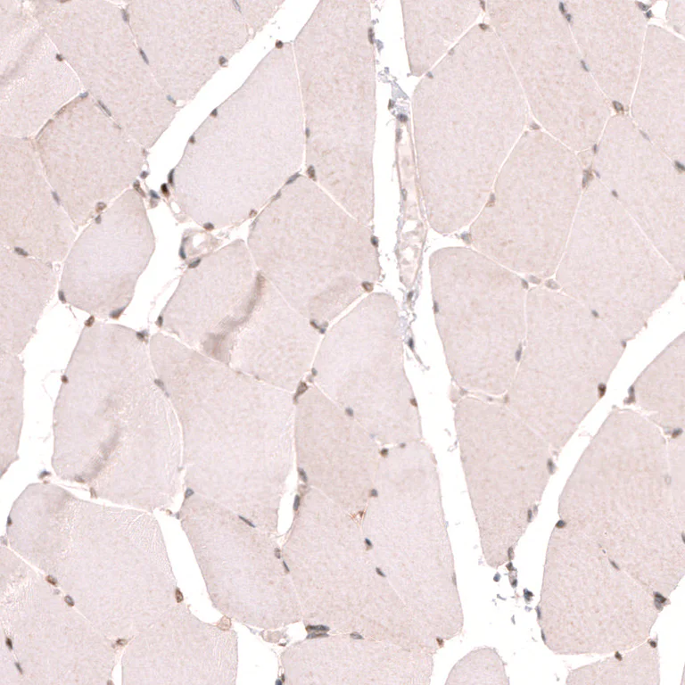 Immunohistochemistry (Formalin/PFA-fixed paraffin-embedded sections) - Anti-NUP54 antibody (AB254722)