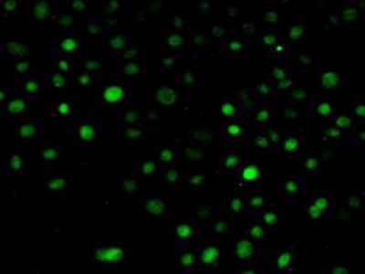 Immunocytochemistry/ Immunofluorescence - Anti-NUP88 antibody (AB231187)