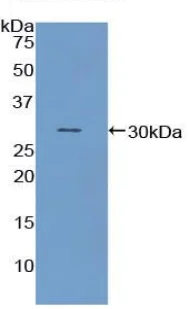 Western blot - Anti-NUP88 antibody (AB231187)