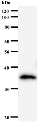 Western blot - Anti-NUP93 antibody [3332C2a] (AB53750)