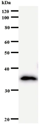 Western blot - Anti-NUP93 antibody [3332C2a] (AB53750)