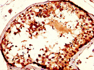Immunohistochemistry (Formalin/PFA-fixed paraffin-embedded sections) - Anti-NUP93 antibody (AB238735)