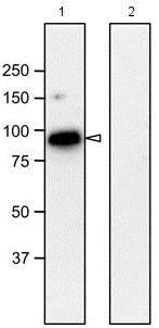 Western blot - Anti-NUP98 antibody [13C2 + 21A10] (AB179911)
