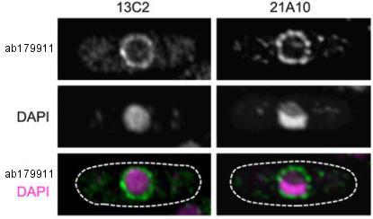 Immunocytochemistry/ Immunofluorescence - Anti-NUP98 antibody [13C2 + 21A10] - BSA and Azide free (AB179911), expandable thumbnail