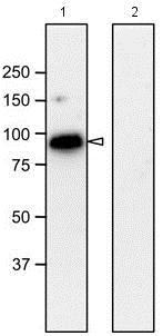 Western blot - Anti-NUP98 antibody [13C2 + 21A10] - BSA and Azide free (AB179911), expandable thumbnail