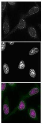 Immunocytochemistry/ Immunofluorescence - Anti-NUP98 antibody [13C2] (AB179894)