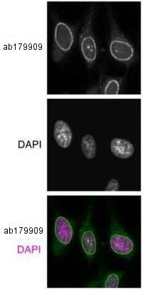 Immunocytochemistry/ Immunofluorescence - Anti-NUP98 antibody [21A10] (AB179909)