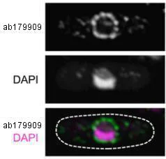 Immunocytochemistry/ Immunofluorescence - Anti-NUP98 antibody [21A10] (AB179909)