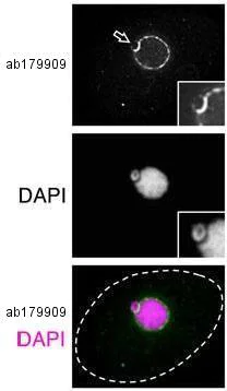 Immunocytochemistry/ Immunofluorescence - Anti-NUP98 antibody [21A10] (AB179909)