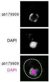 Immunocytochemistry/ Immunofluorescence - Anti-NUP98 antibody [21A10] (AB179909)