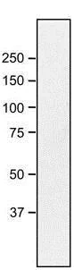 Western blot - Anti-NUP98 antibody [21A10] (AB179909)