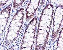 Immunohistochemistry (Formalin/PFA-fixed paraffin-embedded sections) - Anti-NUP98 antibody [EPR6678] - BSA and Azide free (AB226102)