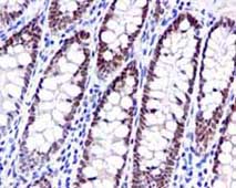Immunohistochemistry (Formalin/PFA-fixed paraffin-embedded sections) - Anti-NUP98 antibody [EPR6678] - Nuclear Pore Marker (AB124980)